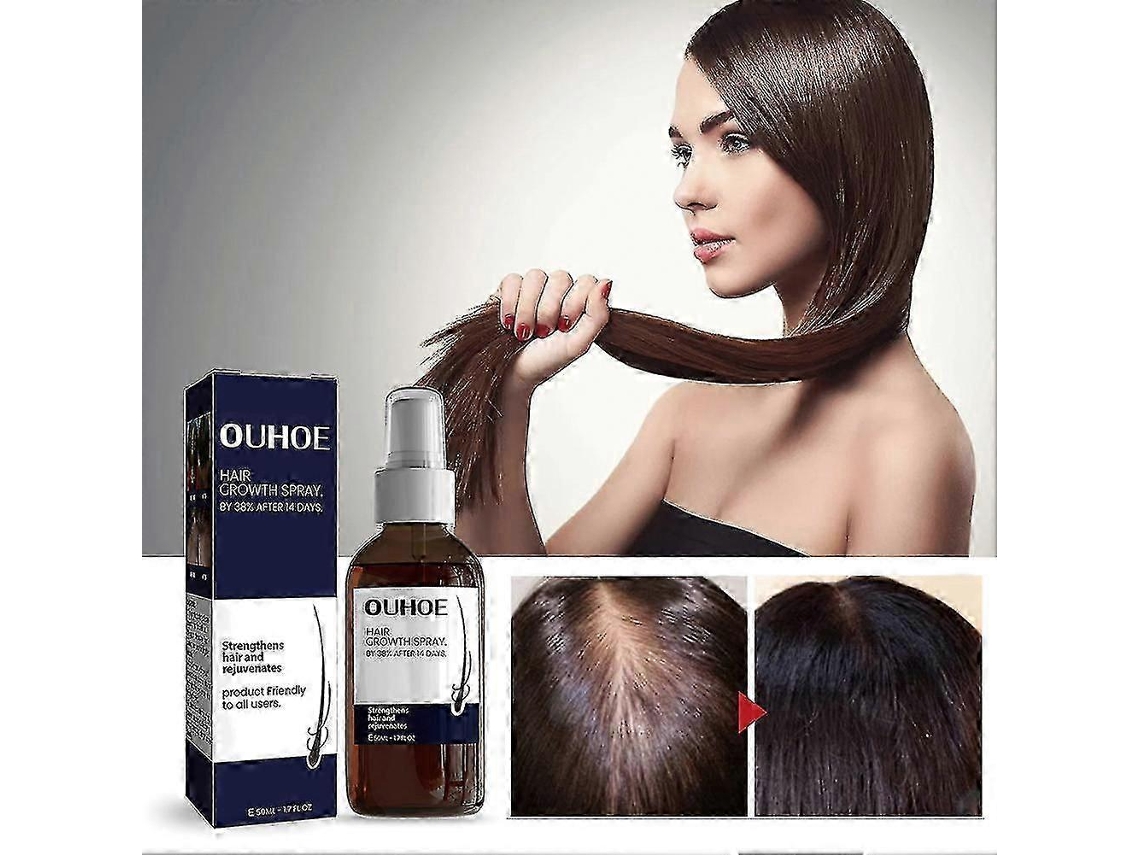2pcs—1-3pcs 50ml Hair Growth Spray Moisturizes Scalp Hair Damaged Strong Hair Dense Hai