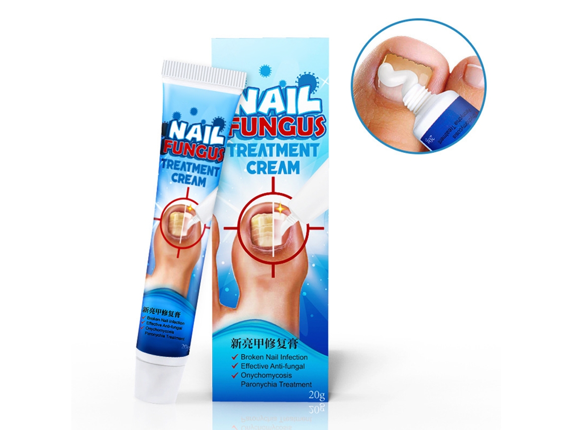Crema Para Hongos En Las Uñas 20 G - Elimina Los Hongos De Las Uñas De Las Manos Y Los Pies - Fácil De Aplicar