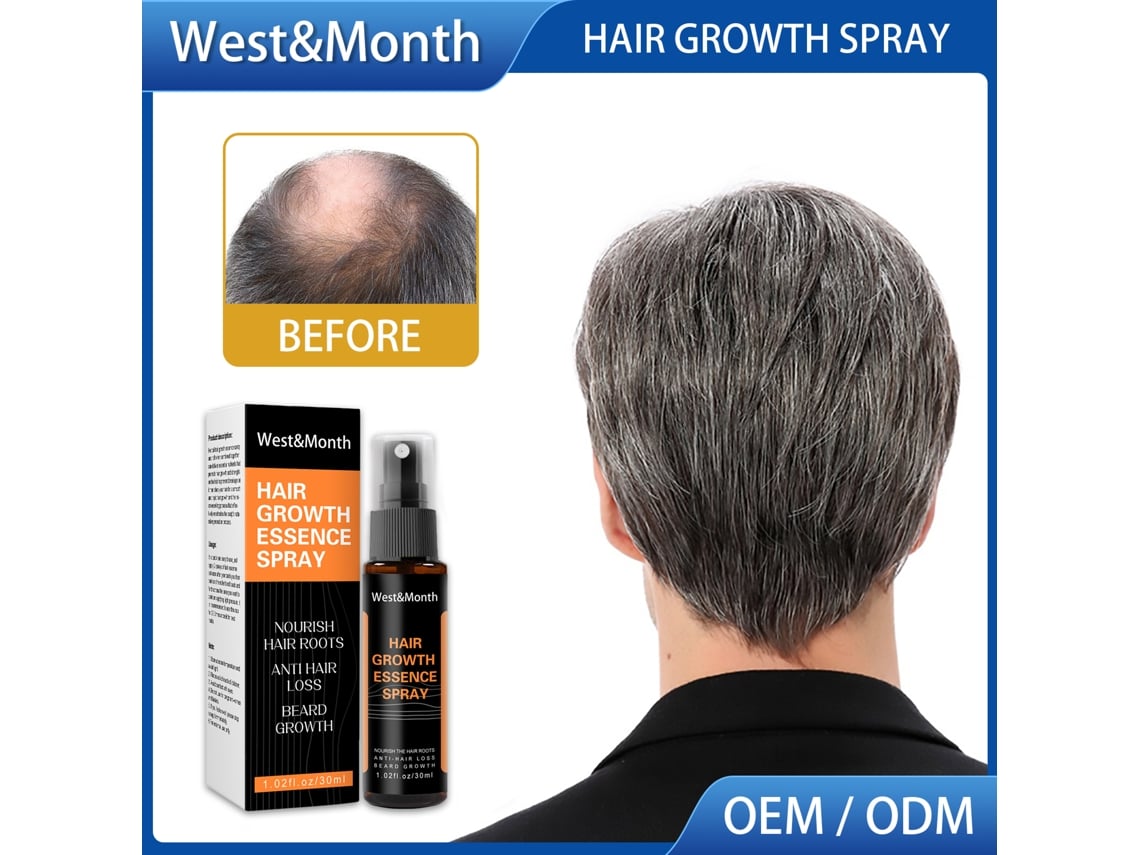 Óleo em spray para crescimento capilar 2026-westmonth 30ml/frasco Nutrição e reparação do couro cabeludo e cuidados com os cabelos