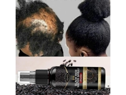 Spray Para El Crecimiento Del Cabello Con Arroz Negro: Repara El Cabello Dañado E Hidrata Todo Tipo De Cabello (3 Unidades).