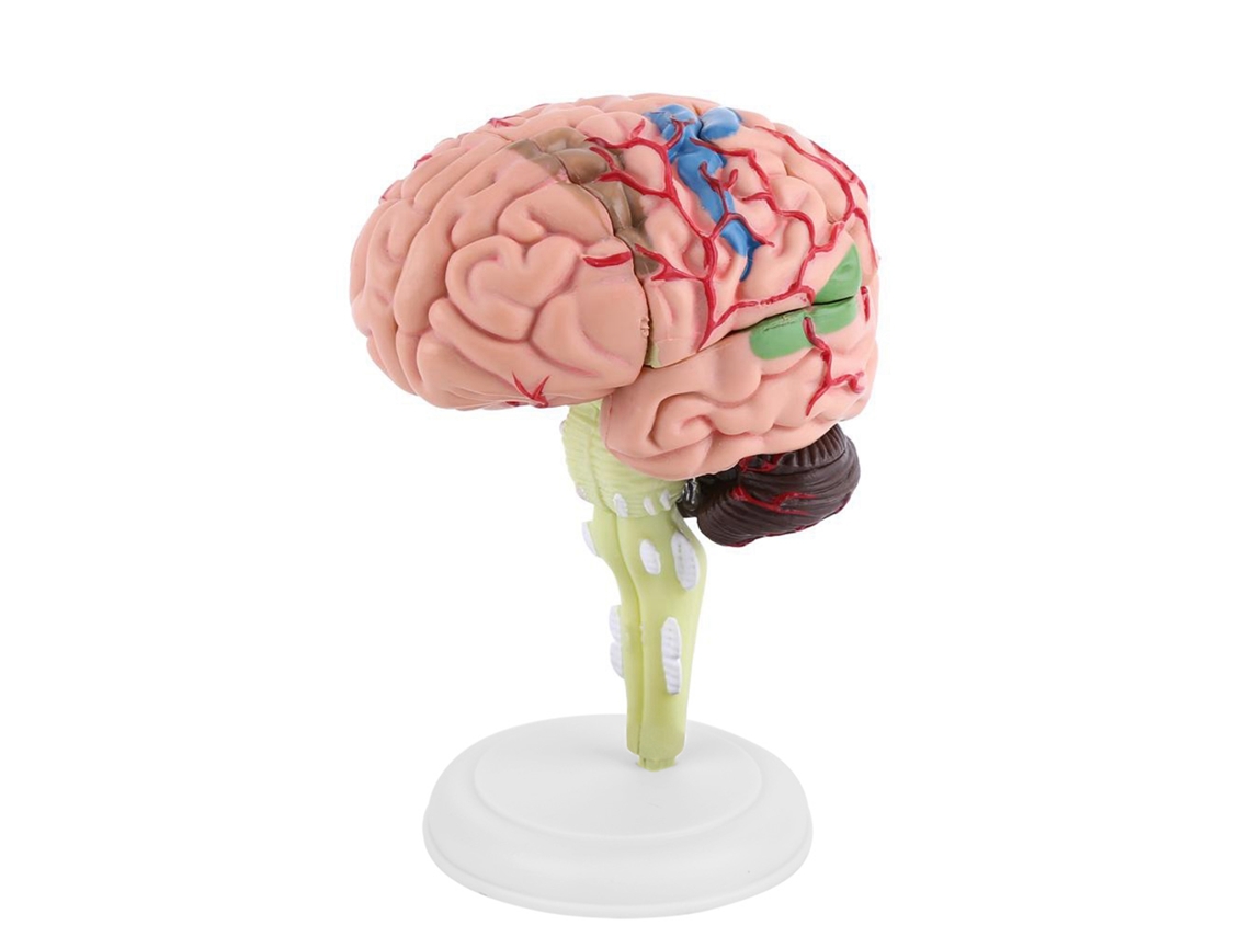 Modelo Anatómico Desmontable Del Cerebro Humano, Herramienta Didáctica Médica, Juguete.