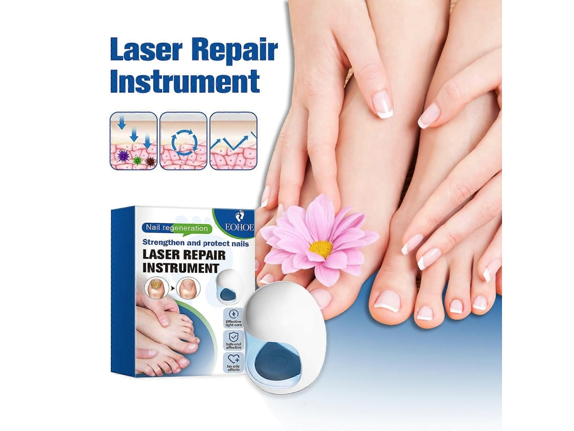 Aparelho A Laser Para Limpeza De Fungos Nas Unhas, Tratamento A Laser Para Onicomicose, Tratamento De Fungos Nas Unhas Das Mãos E Dos Pés Com Ter