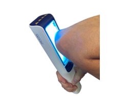 Lámpara de fototerapia UVB de 311 nm para enfermedades de la piel, psoriasis, vitíligo y eczema.