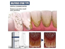 Spray Disolvente De Sarro Para Dientes Con Blanqueamiento Instantáneo Y Eliminación De Manchas.