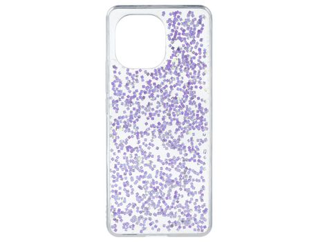 Funda Glitter Premium para Xiaomi Mi 11