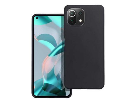 Carcasa Xiaomi Mi 11 Lite 5G / Mi 11 Lite Lte NC