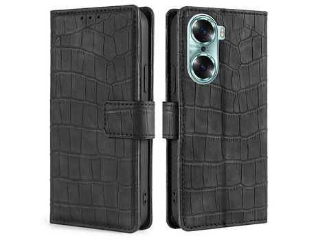 Carcasa para Honor 60