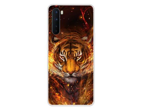 Carcasa para OnePlus nord