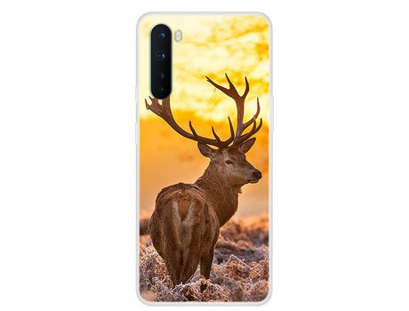 Carcasa para Oneplus Nord