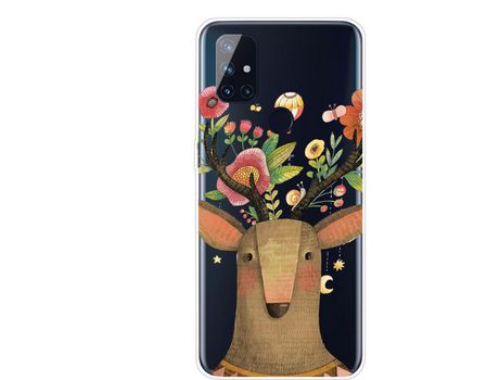 Carcasa para Oneplus Nord N10 5G