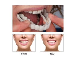 Protector dental superior e inferior de silicona blanca listo para usar, de fácil colocación. Herramienta cosmética CDT.