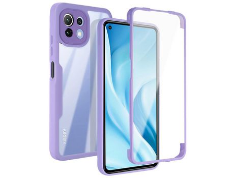 Carcasa para Xiaomi Mi 11 Lite 4G