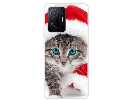 Carcasa para Xiaomi 11T