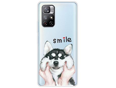 Carcasa para Xiaomi Redmi Note 11