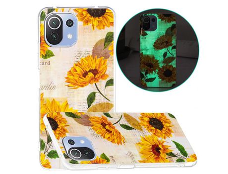 Carcasa para Xiaomi Mi 11 Lite 4G