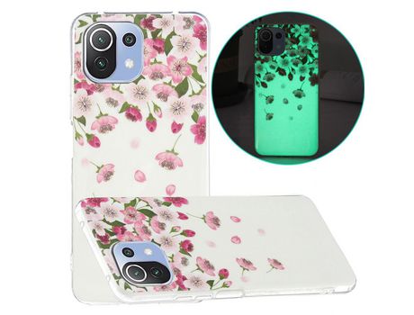Carcasa para Xiaomi Mi 11 Lite 4G