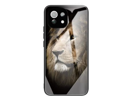 Carcasa para Xiaomi Mi 11 Lite 4G