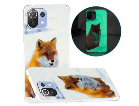 Carcasa para Xiaomi Mi 11 Lite 4G