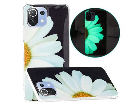 Carcasa para Xiaomi Mi 11 Lite 4G