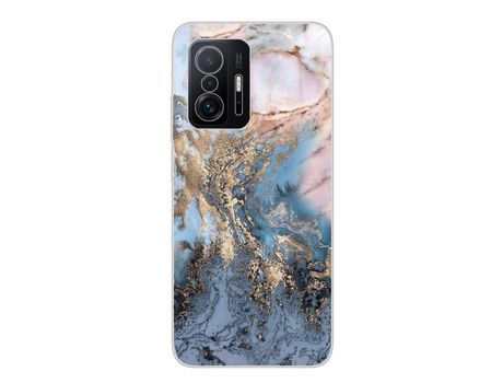 Carcasa para Xiaomi 11T 5G