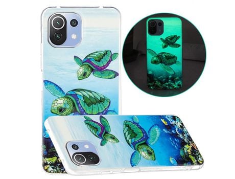 Carcasa para Xiaomi Mi 11 Lite 4G