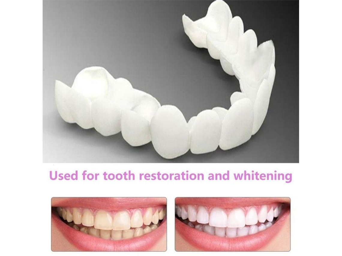 Protector Dental Simulado Universal Jxh Para La Corrección Estética Y Reparación De Dientes Defectuosos.