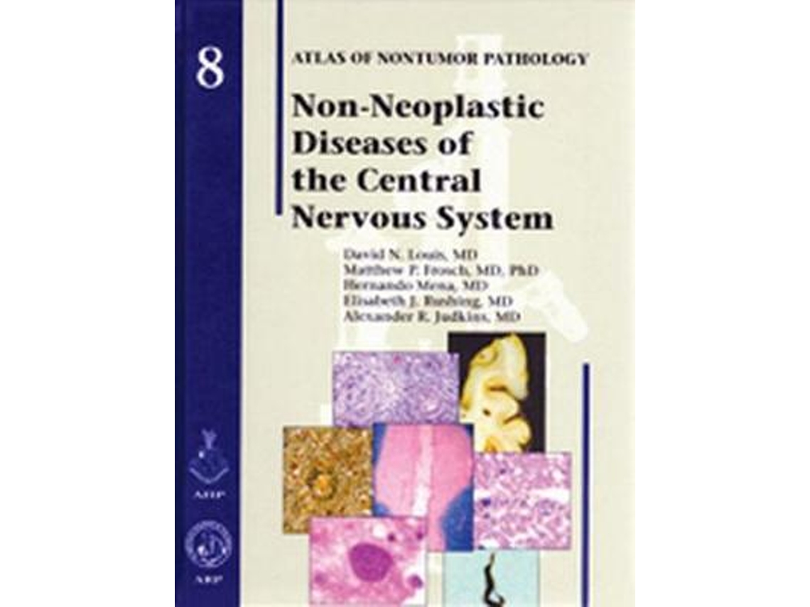 Libro Non-Neoplastic Diseases of the Central Nervous System (Inglés)