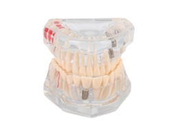Modelo Dental Didáctico Con Encía Transparente Y Estructura Clara.