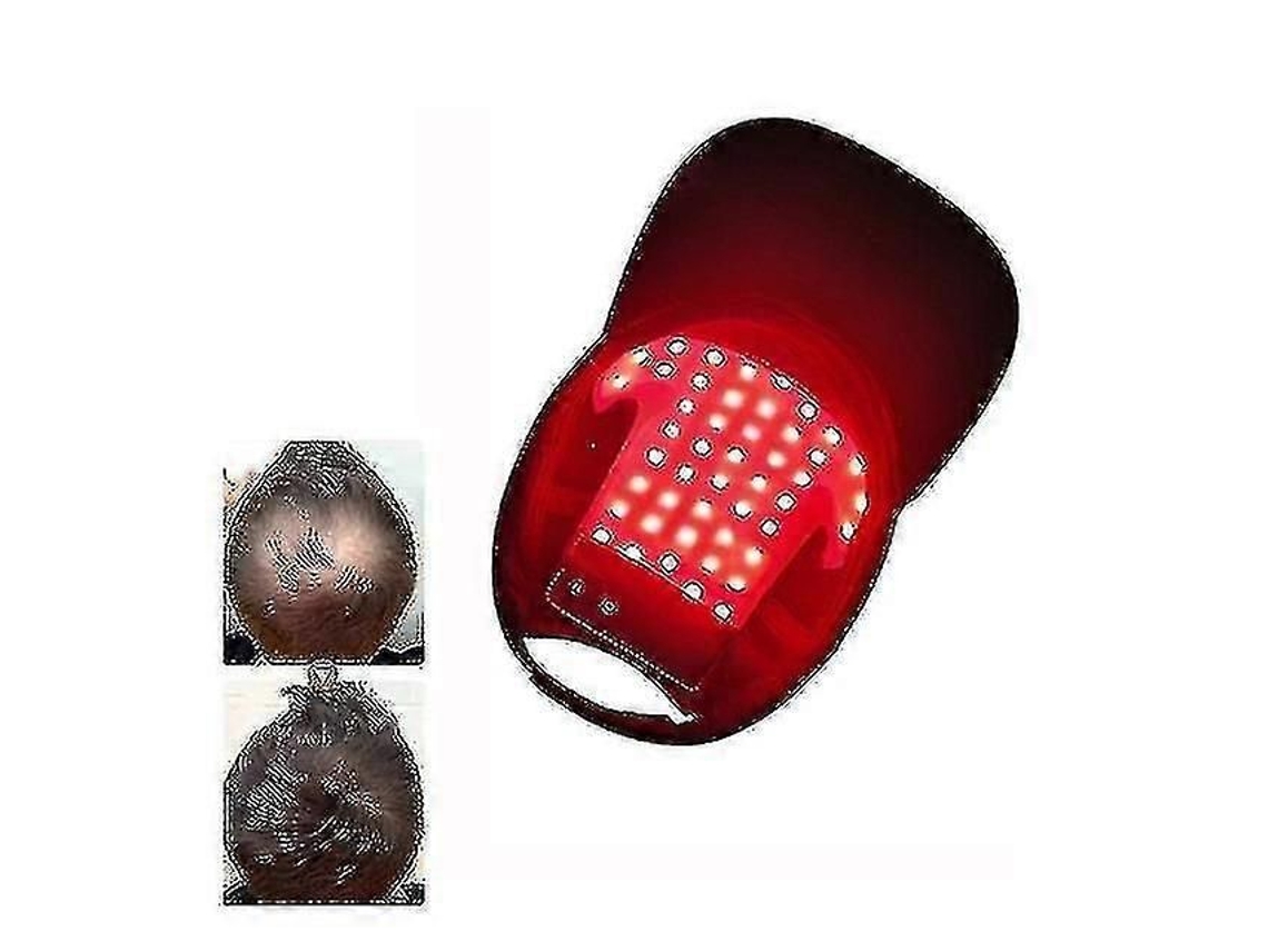 Dispositivo de terapia de luz roja, gorro para el crecimiento del cabello, casco láser anticaída, Recrowth GOKOCO