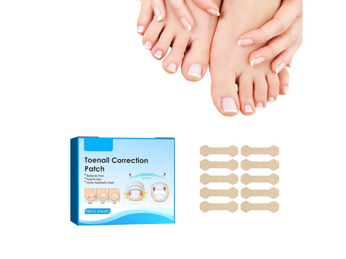 Parches correctores de uñas rojos, pegatinas, herramienta para corregir las uñas, herramientas de pedicura