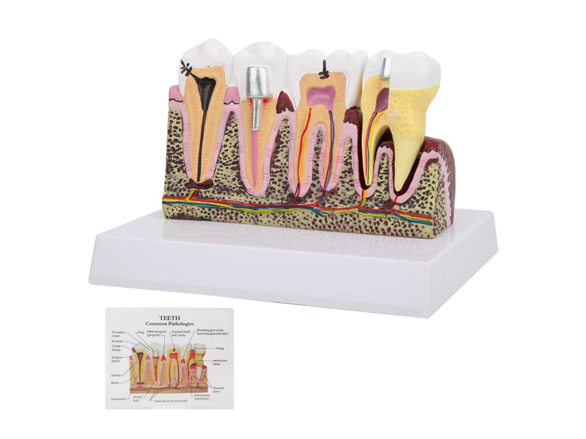 Modelo Anatómico Dental Removible Con Base Para Enseñanza Y Demostración.