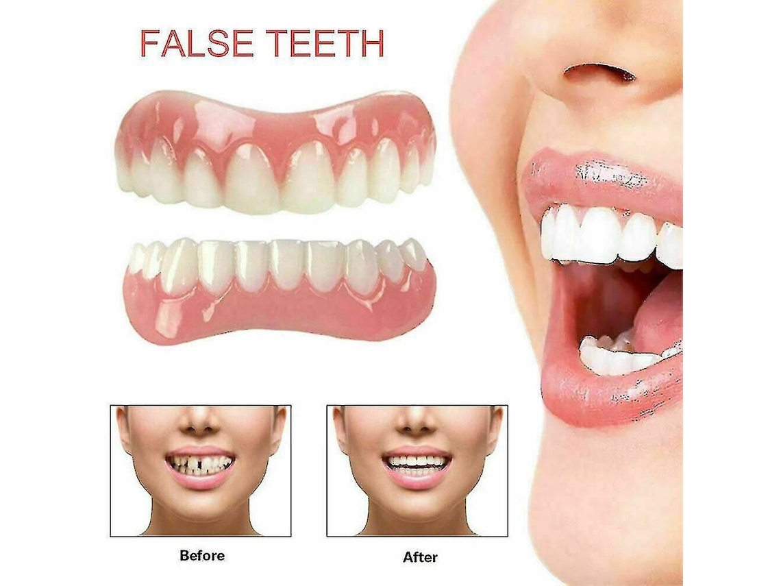 Carillas De Alta Calidad, Dientes Postizos, Carillas De Quita Y Pon Para Una Sonrisa Instantánea, Prótesis Dentales Cosméticas.