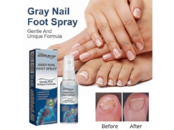 South Moon Onychomycosis Repair Spray Moisturizes And Cleans Odor Onychomycosis Soft Nail Dry Na