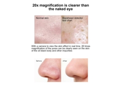 Extractor De Puntos Negros Con 4 Cabezas De Succión 6 Velocidades Limpiador Facial Profundo Herramienta De Belleza Para El Hogar
