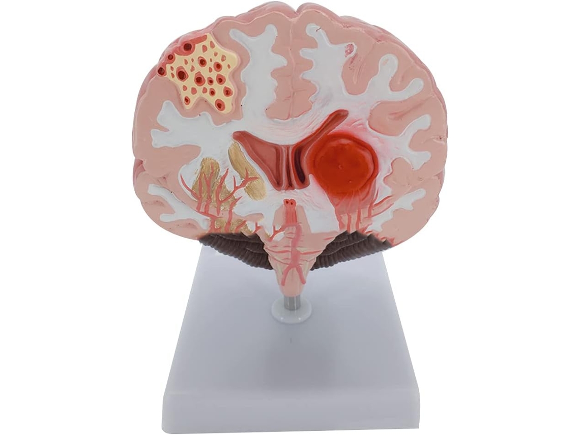 Modelo Anatómico Humano Con Arterias De La Corteza Cerebral Para Conferencias.