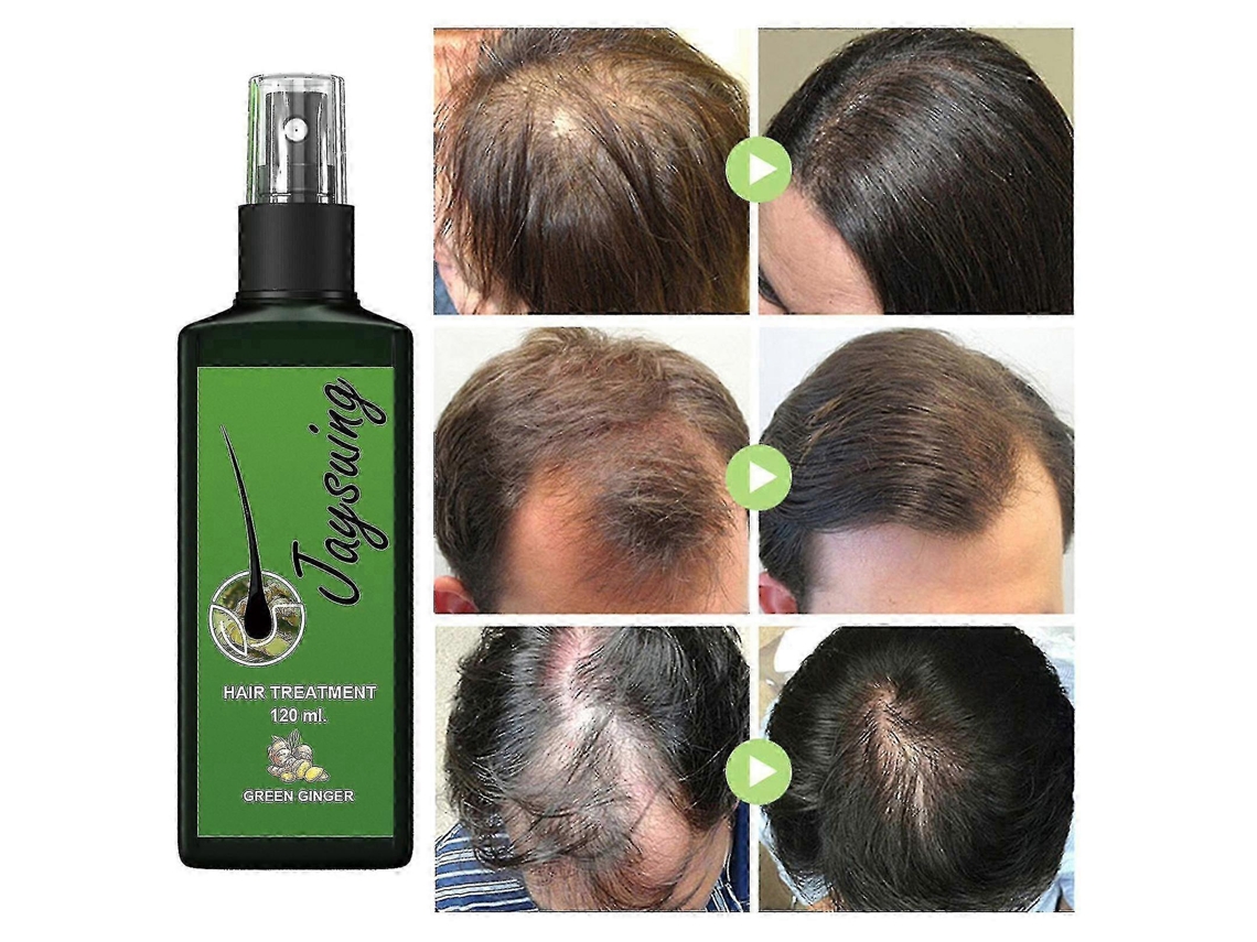 120ml—jaysuing Of Hair Care Liquid Strong Hair To Prevent Hair Root Massage Nourishing Liquid Thick Scalp