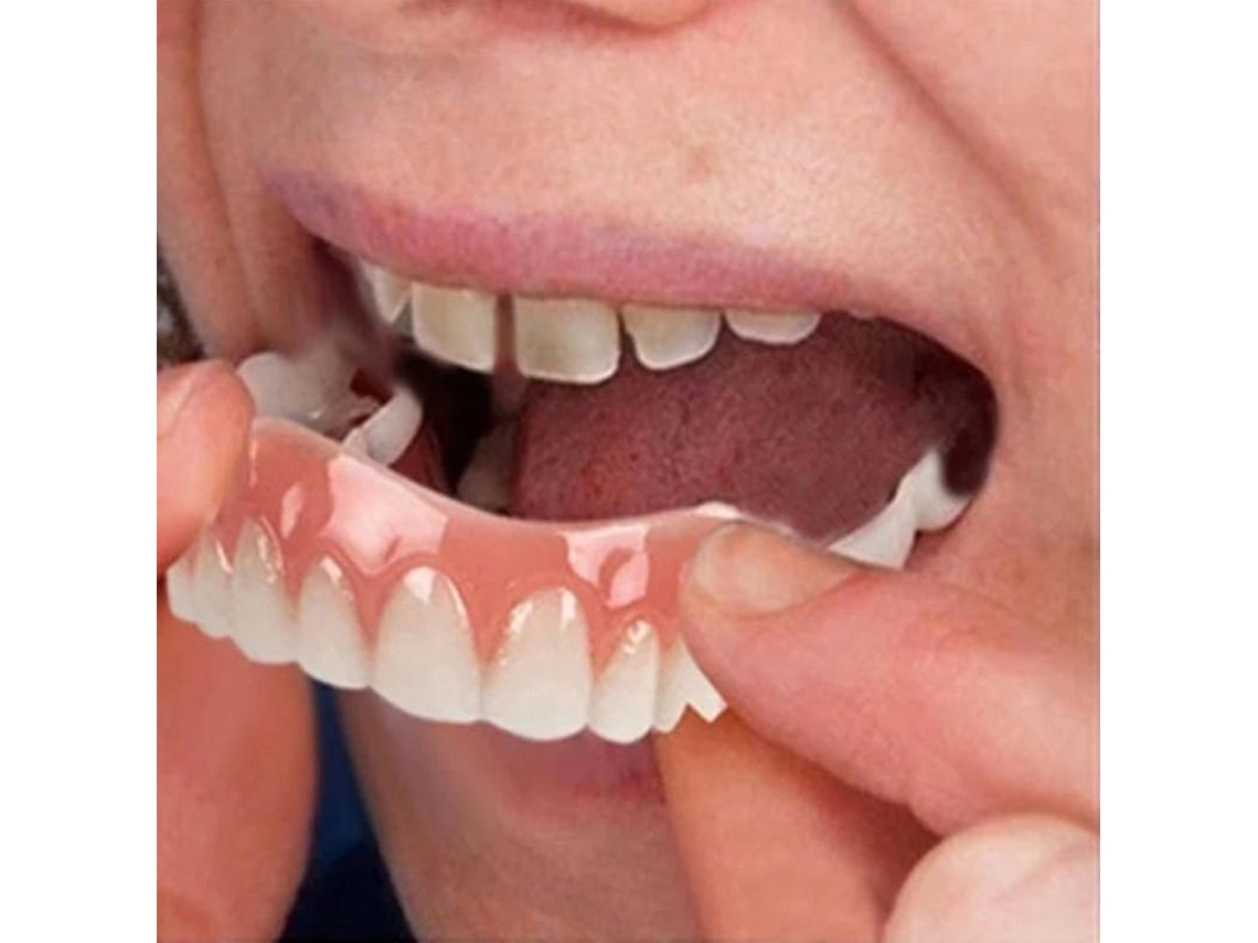 As lentes de contato dentais Rebe-falsas, ultrafinas e brancas, possuem adesivo seguro que disfarça manchas e espaços, garantindo um sorriso perfeito.