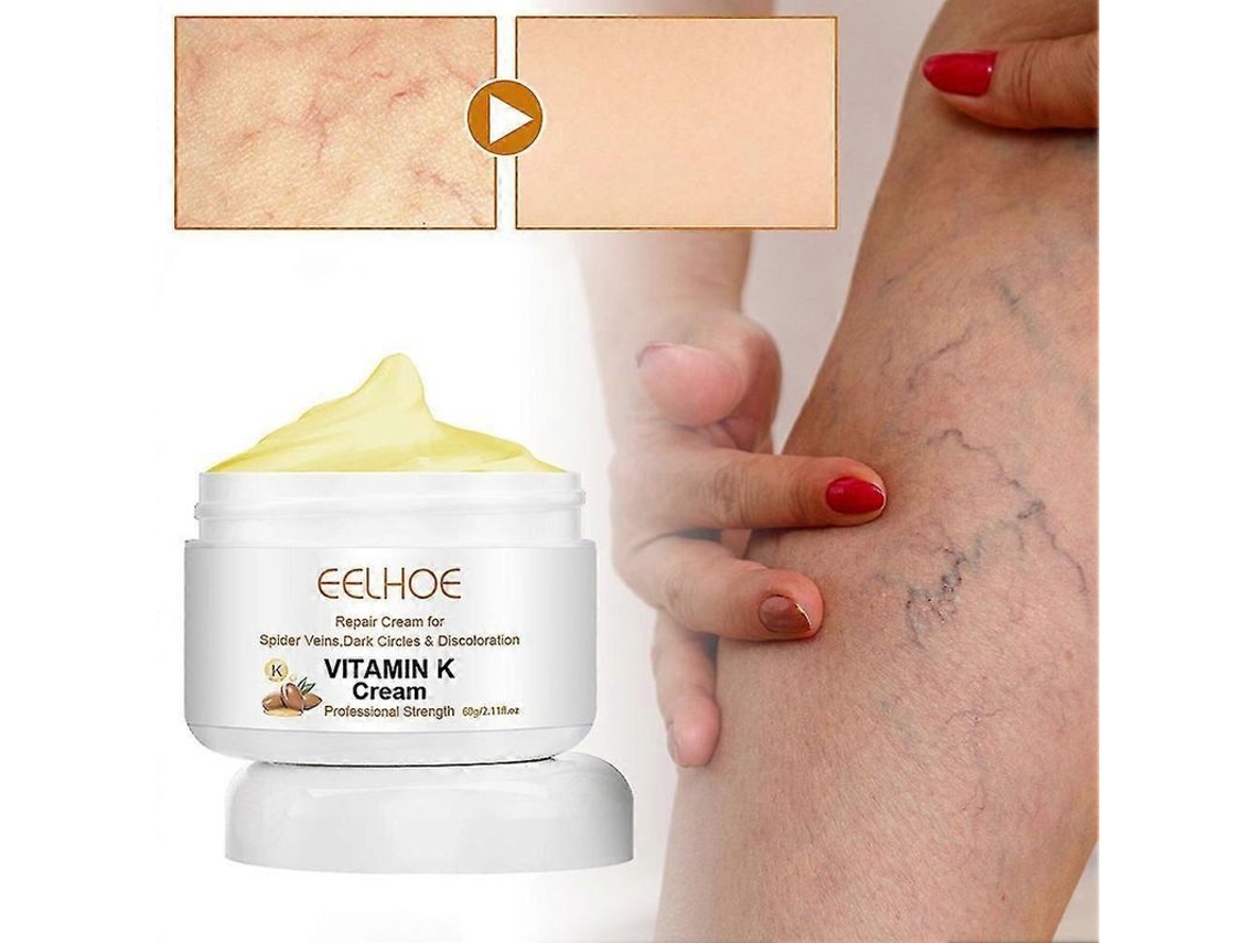 Crema De Vitamina K 60 G Para El Tratamiento De Varices, Masaje Multiusos Para Piernas Con Varices, 1 Unidad.