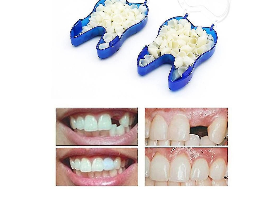 Prótesis Dentales Temporales Para Dientes Faltantes O Rotos, Apariencia Natural, 100 Unidades.