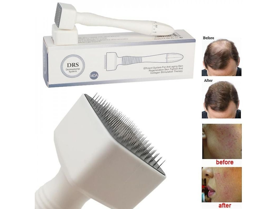 Agujas De Microagujas Estampa Derma 140a De Longitud Ajustable Para El Crecimiento Del Cabello, La Barba Y El Tratamiento De Cicatrices.