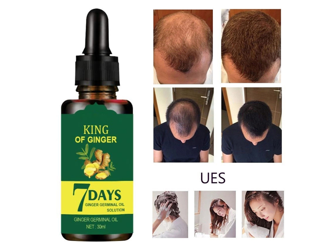 Sérum de Gengibre 2026 para Crescimento Capilar 30ml, Controle da Oleosidade e Queda de Cabelo, Cuidado Capilar para Homens e Mulheres