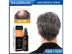 Óleo em spray para crescimento capilar 2026-westmonth 30ml/frasco Nutrição e reparação do couro cabeludo e cuidados com os cabelos