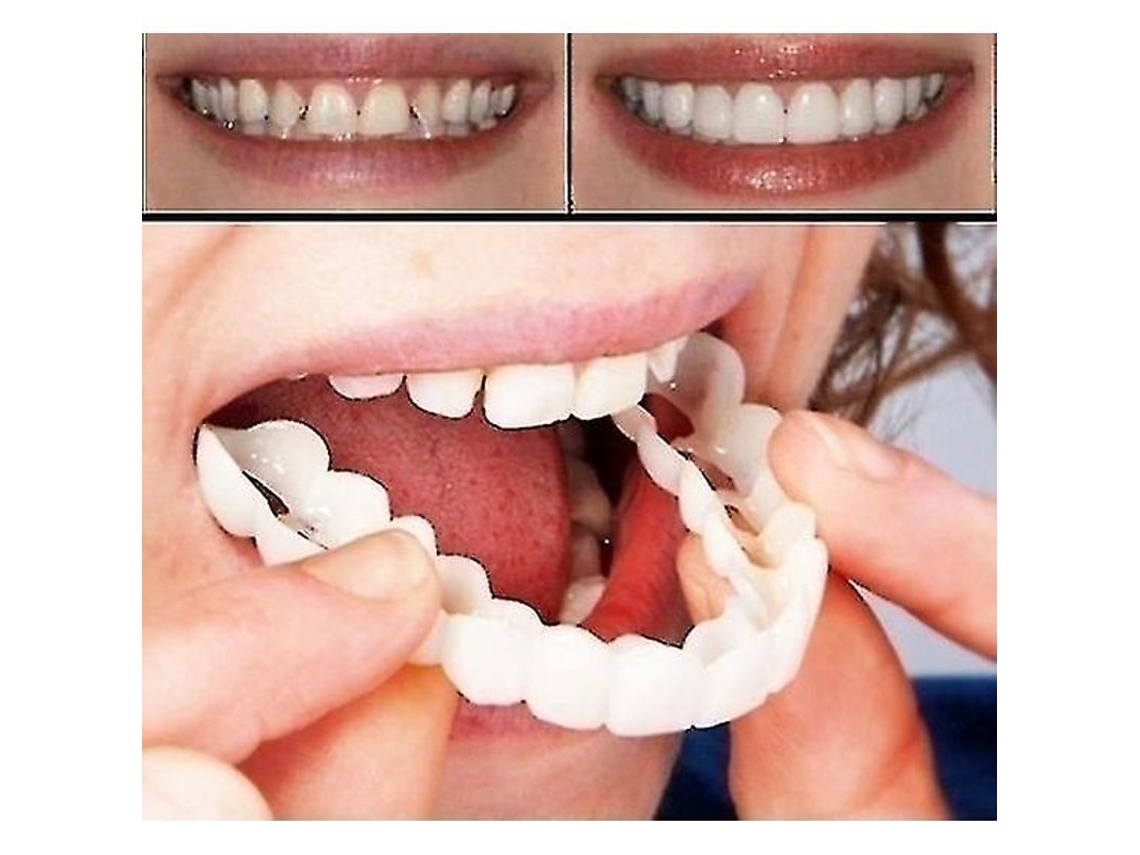 Prótesis Dentales Superiores E Inferiores Instant Smile De Alta Calidad, Ajuste Cómodo, Carillas Cosméticas.