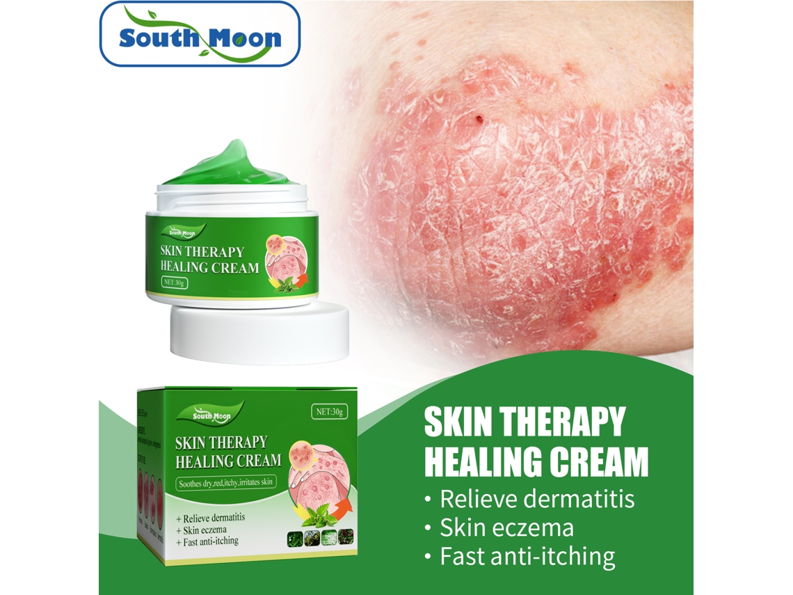 Crema antipicazón para piel húmeda y ampollada, alivia la picazón, la dishidrosis, las erupciones y los sofocos Truyuety
