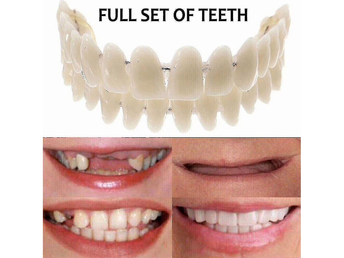 Protesis Dental Superior Inferior - Carillas Dentales Removibles Para Sonrisa Perfecta