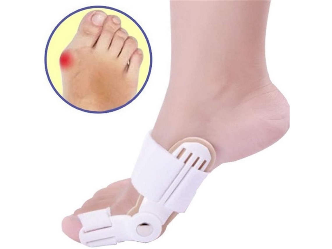 Corrección De Pies Planos: Corrección De Dedos Y Hallux Valgus, Alivio Del Dolor, Ortopédico.