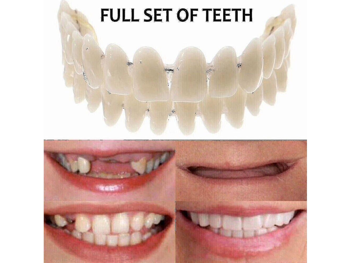 Rebe-falsas Dientes Snap On Superiores Inferiores Veneers Dentales Prótesis Revestimiento De Resina Blanco Alta Calidad