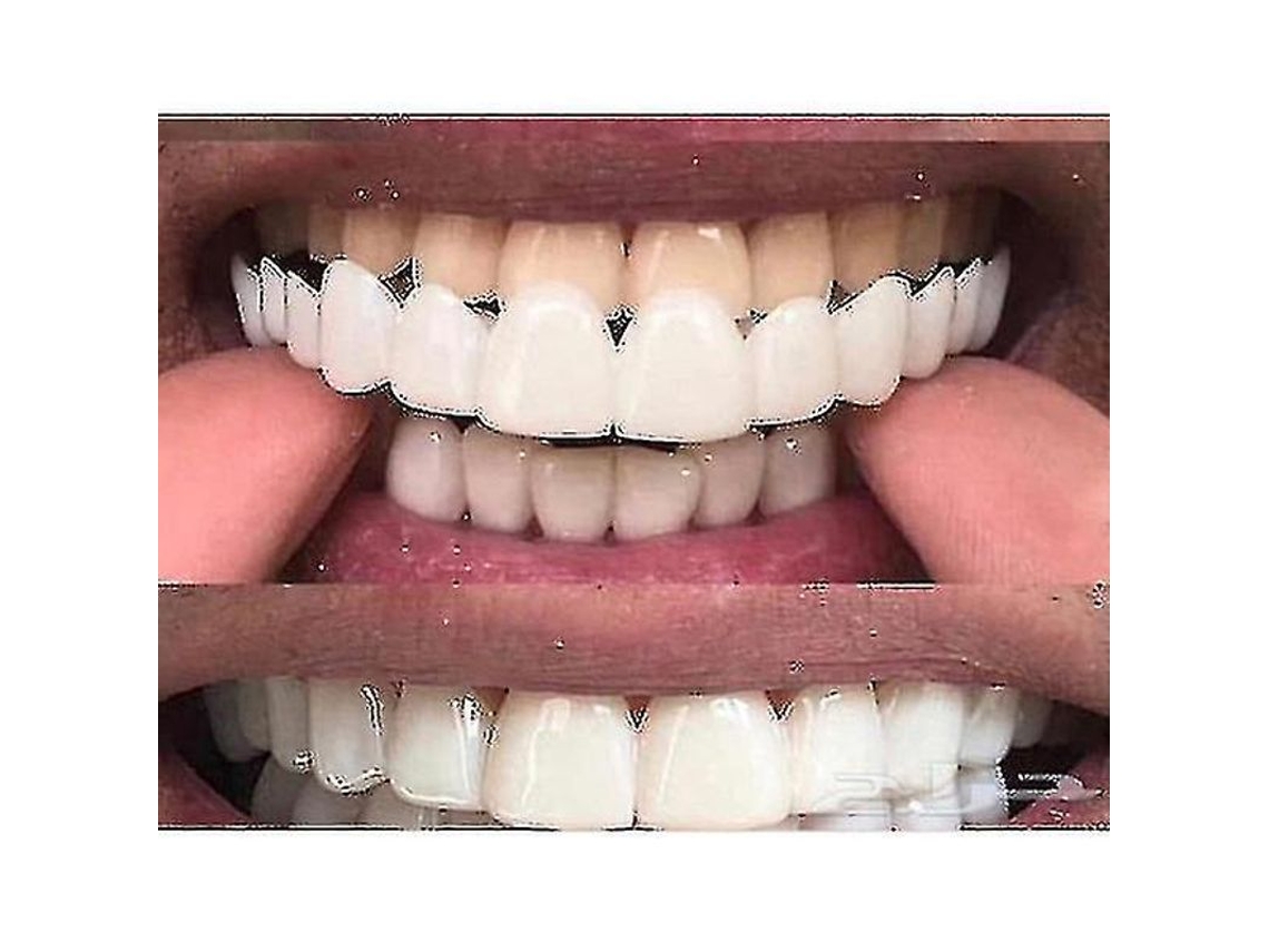 Arcos Dentales Blancos Comfort Fit Flex Para Dientes Superiores E Inferiores
