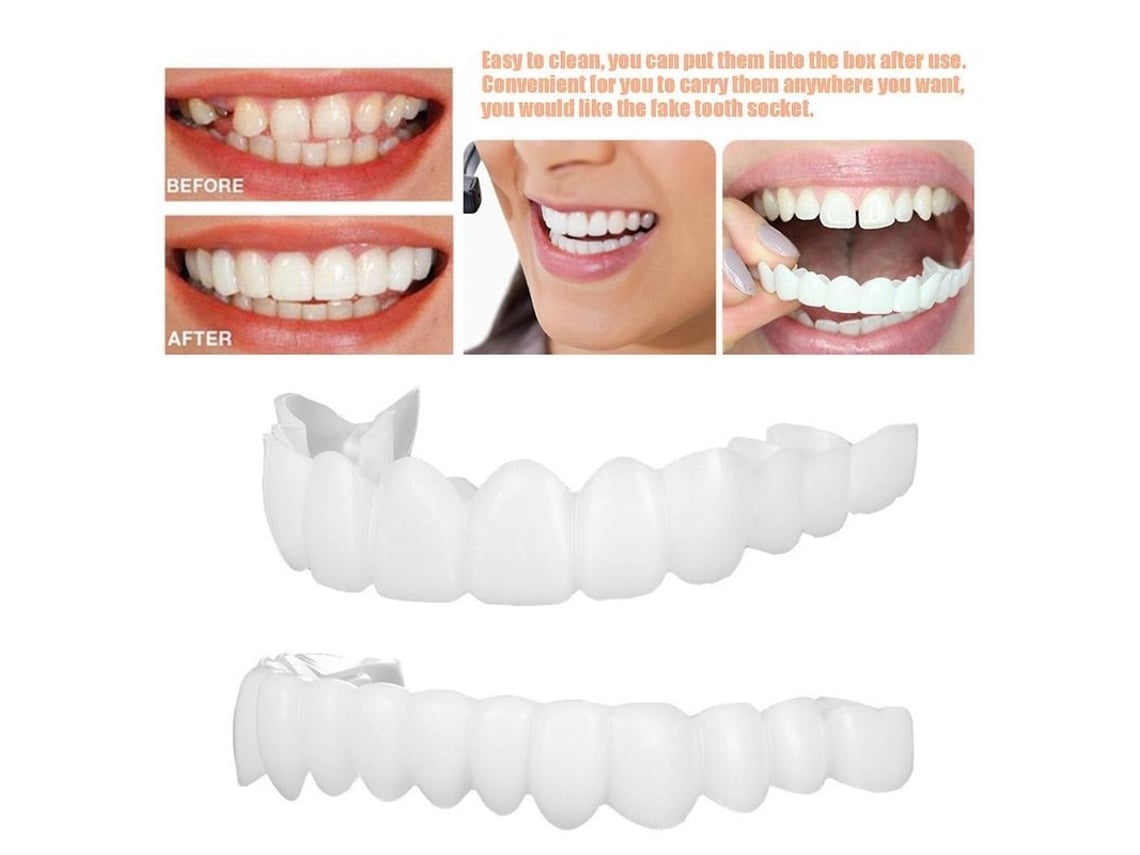 Juego De Carillas Dentales Postizas Superiores E Inferiores Con Estuche Para Prótesis Y Gutapercha.