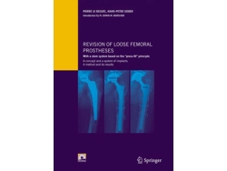 Libro Revision of loose femoral prostheses with a stem system based on the "press-fit" principle (Inglés)